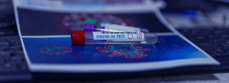 Read more about the article Neuregelung in Bezug auf Covid-19 – Dokumentation Immunisierungs- und Testnachweise – Stand 22.11. 2021